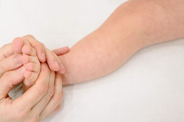 hand foot and mouth disease in babies
